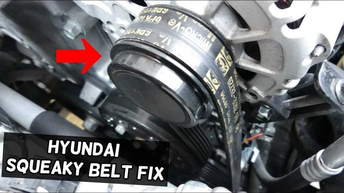 2018 hyundai elantra belt diagram